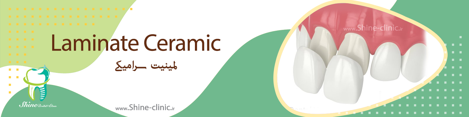 لمینیت سرامیکی